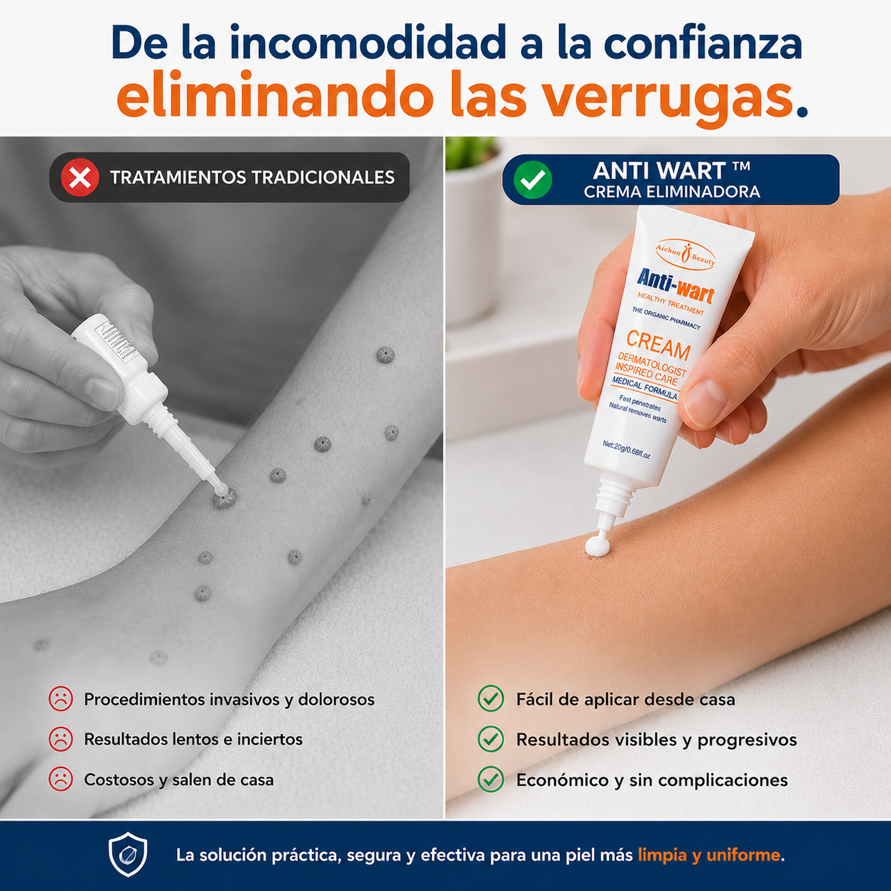 Anti Wart™ - Crema - Eliminador de Verrugas