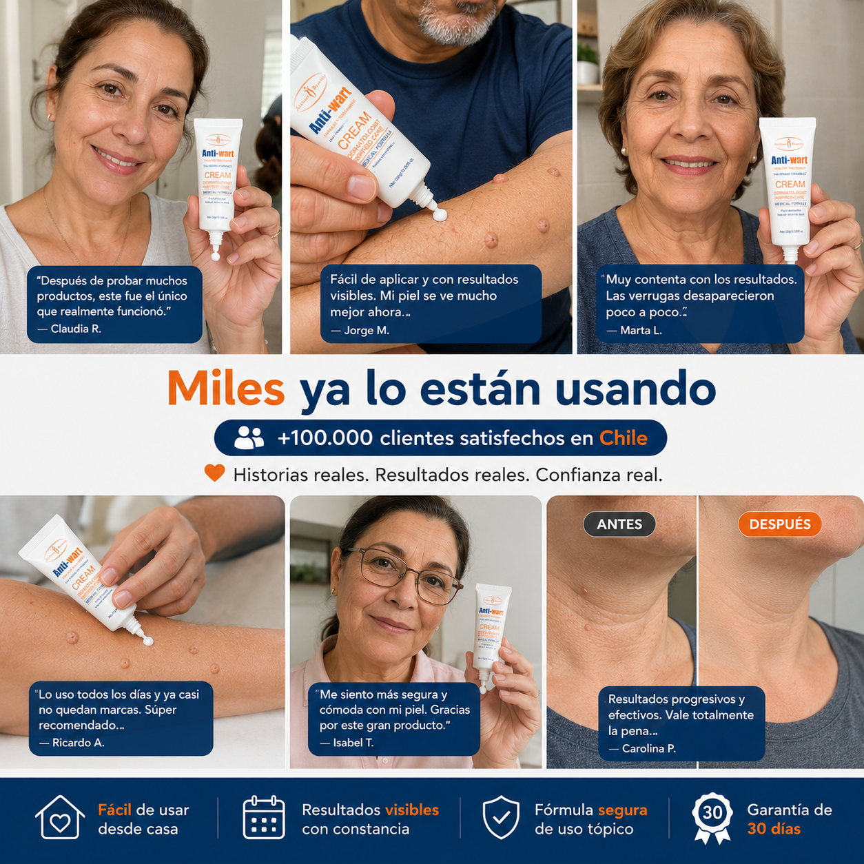 Anti Wart™ - Crema - Eliminador de Verrugas